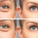 ojeras_eficacia-1.webp