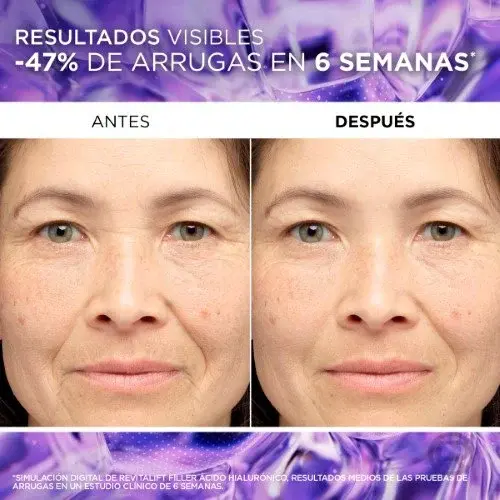 serum-revitalift-reno-2025-(2).webp