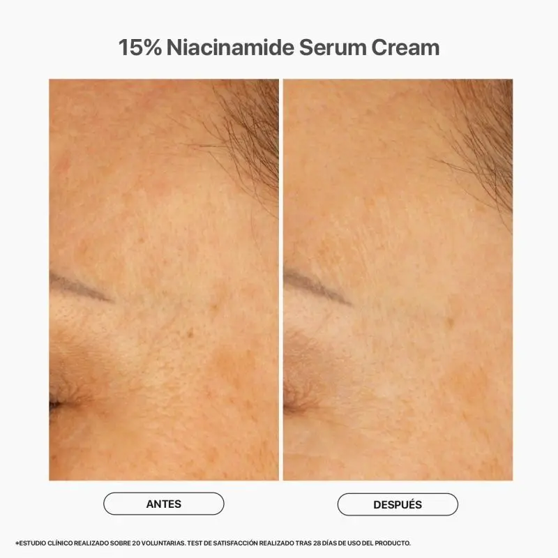 serum-crema-15-niacinamide (1).webp