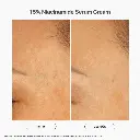 serum-crema-15-niacinamide (1).webp