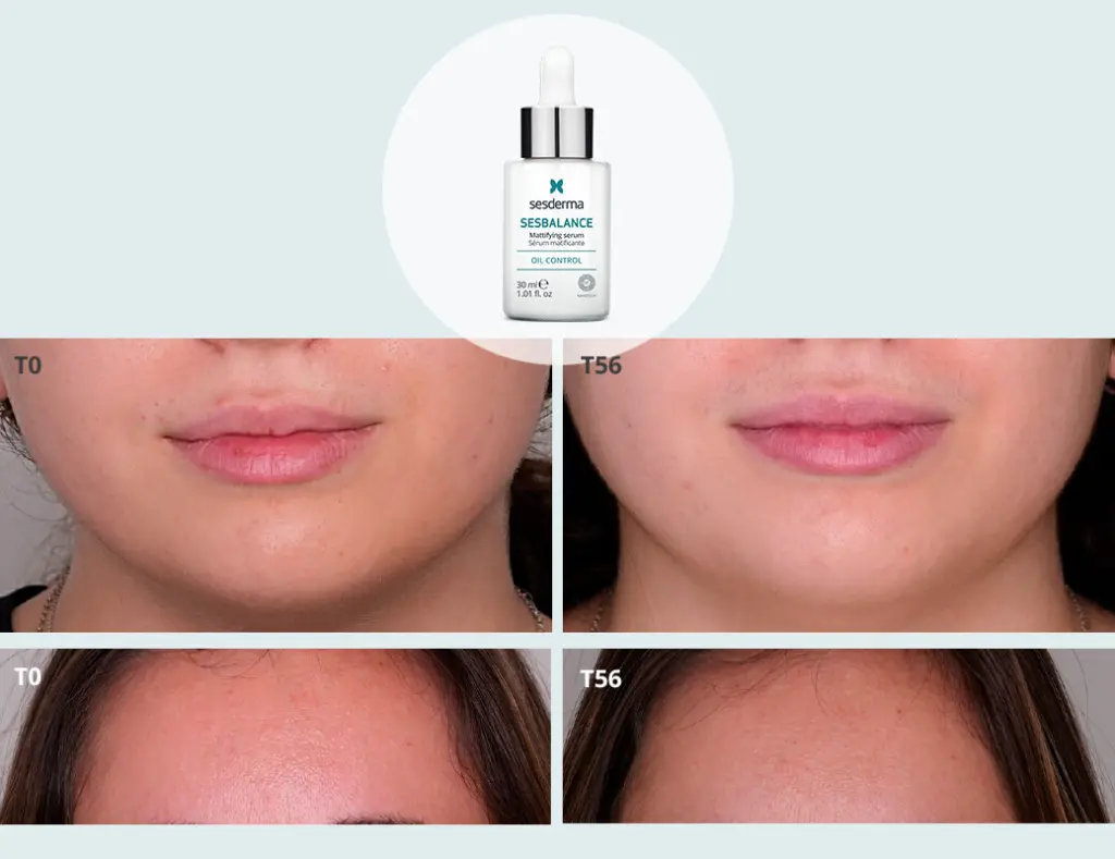 Foto_estudio_serum_Sesbalance_2.webp