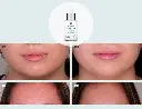 Foto_estudio_serum_Sesbalance_2.webp