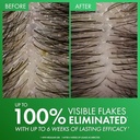 Vichy Dercos Selenium Sulfide Anti-Dandruff Shampoo (Various Sizes)