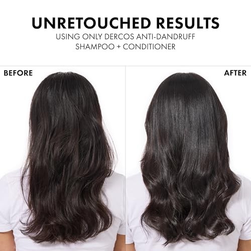 Vichy Dercos Selenium Sulfide Anti-Dandruff Shampoo (Various Sizes)